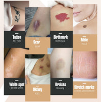 Pegatinas PerfectSkin™️ Cubre todas las imperfecciones