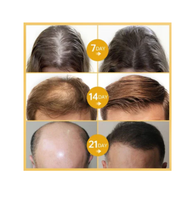 Batana Hair Oil™ revive tu cabello como nunca