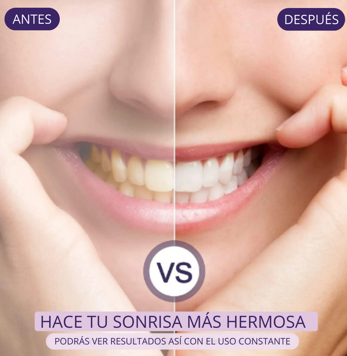 Corrector dental S10™️ tu paso seguro a una sonrisa radiante