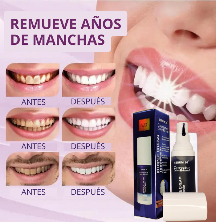 Corrector dental S10™️ tu paso seguro a una sonrisa radiante