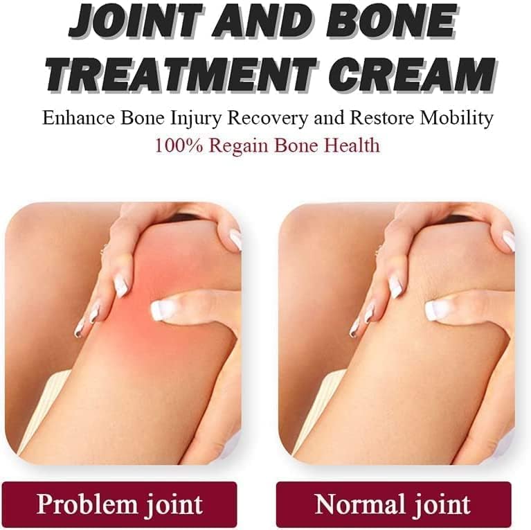 Crema Perfectx™️ Para Dolores Musculares Y Articulares Tellegoacasa